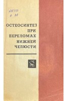 Остеосинтез при переломах нижней челюсти (БУ). Дунаевский В.А. Соловьев М.М. Павлов Б.Л. Магарилл Е.Ш.
