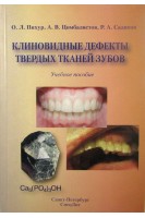 Клиновидные дефекты твердых тканей зубов. Пихур О.Л. Кузьмина Д.А.