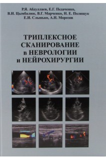 Триплексное сканирование в неврологии и нейрохирургии. Абдуллаев Р.Я. Педаченко Е.Г. Цымбалюк В.И.