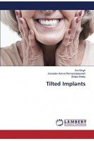 Tilted Implants. Era Singh Jnanadev Kanva Ramasanjeevaiah Shilpa Shetty