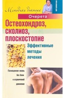 Остеохондроз сколиоз плоскостопие. Эффективные методы лечения. Очерет А.