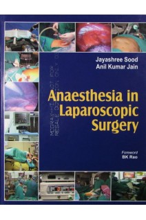 Anaesthesia in Laparoscopic Surgery. Jayashree Sood Anil Kumar Jain