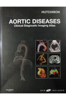 Aortic Diseases: Clinical Diagnostic Imaging Atlas. Hutchinson