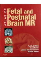 Atlas of Fetal and Postnatal Brain MR. Griffiths