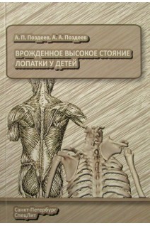 Врожденное высокое стояние лопатки у детей. Поздеев А.П. Поздеев А.А.