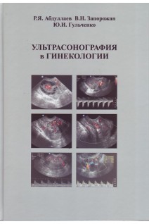 Ультрасонография в гинекологии (формат А4). Абдуллаев Р.Я. Запорожан В.Н. Гульченко Ю.И.