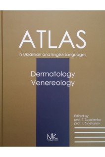 Dermatology. Venerology. (Дерматологія. Венерологія): атлас. Svyatenko T. (Святенко Т.В.)