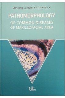 Pathomorhology of common diseases of Maxillofacial area (Патоморфологія основних захворювань щелепно-лицевої ділянки): навчальний посібник. Starcenko I.I. (Старченко І.І.)