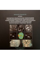 Магнитно-резонансная томография и мультиспиральная компьютерная томография в диагностике опухолевых и неопухолевых заболеваний околоушных слюнных желез: атлас. Бубнова Е.В. Пахомова Н.В.