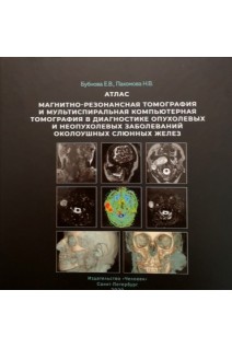 Магнитно-резонансная томография и мультиспиральная компьютерная томография в диагностике опухолевых и неопухолевых заболеваний околоушных слюнных желез: атлас. Бубнова Е.В. Пахомова Н.В.
