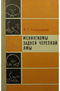 Менингиомы задней черепной ямы (БУ). Станиславский В.Г.