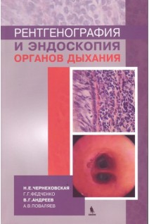 Рентгенография и эндоскопия органов дыхания. Чернеховская Н.Е. Федченко Г.Г. Андреев В.Г. Поваляев А.В.