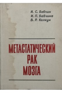 Метастатический рак мозга (БУ). Бабчин И.С.
