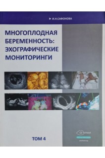 Многоплодная беременность: эхографические мониторинги. Т.4. Сафонова И.Н.
