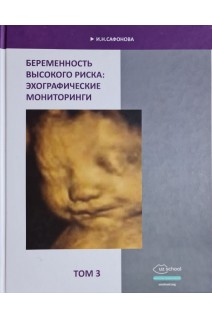 Беременность высокого риска: эхографические мониторинги. Т.3. Сафонова И.Н.