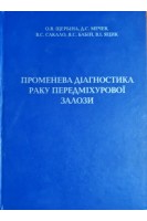 Променева діагностика раку передміхурової залози. Щербіна О.В. Мечев Д.С Сакало В.С.