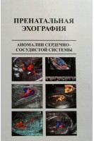 Пренатальная эхография. Аномалии сердечно-сосудистой системы: учебное пособие. Абдуллаев Р.Я. и др.