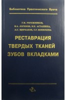Реставрация твердых тканей зубов вкладками. Рогожников