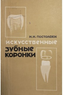 Искусственные зубные коронки (БУ). Постолаки И.И.