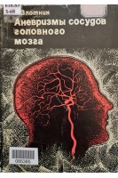 Аневризмы сосудов головного мозга (БУ). Злотник Э.И.