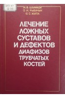 Лечение ложных суставов и дефектов диафизов трубчатых костей (БУ). Шумада И.В. Рыбачук О.И. Жила Ю.С.