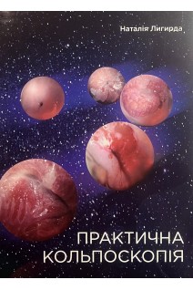 Практична кольпоскопія. 2-е видання доповнене. Лигирда Н.Ф.