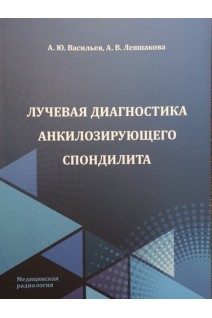 Лучевая диагностика анкилозирующего спондилита. Васильев А.Ю. Левшакова А.В.