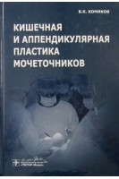 Кишечная и аппендикулярная пластика мочеточников. Б. К. Комяков