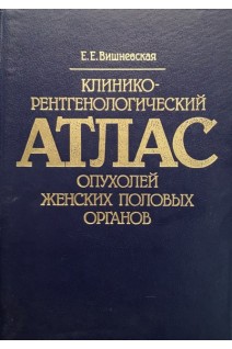 Клинико-рентгенологический атлас опухолей женских половых органов (БУ). Вишневская Е.Е.