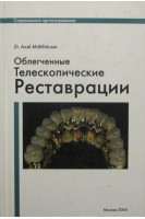 Облегченные телескопические реставрации. Axel Muhlhauser