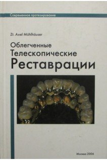 Облегченные телескопические реставрации. Axel Muhlhauser