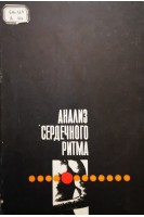 Анализ сердечного ритма (БУ). Жемайтите Д.