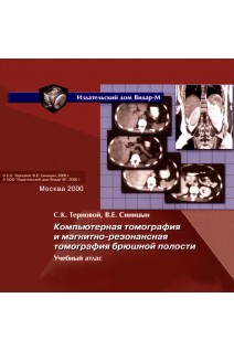 CD. Компьютерная томография и магнитно-резонансная томография брюшной полости. С.К. Терновой и В.Е. Синицына