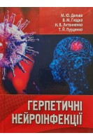 Герпетичні нейроінфекції. Дельва М.Ю. Гладка В.М. Литвиненко Н.В.