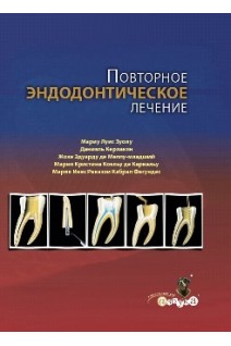 Повторное эндодонтическое лечение. Мариу Луис Цуоло