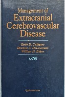 Management of Extracranial Cerebrovascular Disease (БУ). Keith D. Calligaro Dominic A. Delaurentis William H. Baker