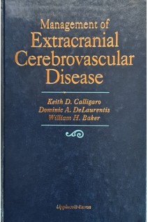 Management of Extracranial Cerebrovascular Disease (БУ). Keith D. Calligaro Dominic A. Delaurentis William H. Baker