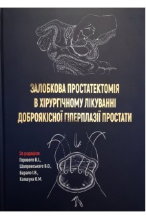 Залобкова простатектомія в хірургічному лікуванні доброякісної гіперплазії простати. Горовий В.І. Шапринський В.О. Барало І.В. Капшук О.М.