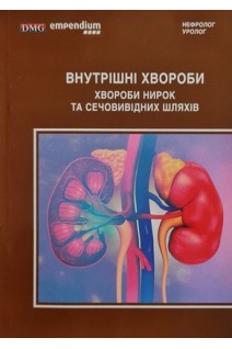 Внутрішні хвороби. Хвороби нирок та сечовивідних шляхів. Войцех М. Дзємянко І. та ін.