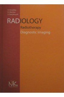 Radiology. Radiotherapy. Diagnostic Imaging. (Радіологія. Променева терапія. Променева діагностика). Kovalsky О. (Ковальський О.)
