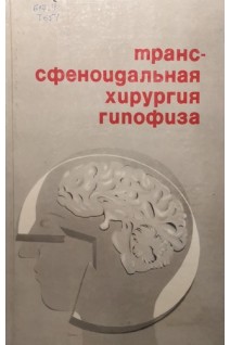 Транссфеноидальная хирургия гипофиза (БУ). Арутюнов А.И.