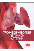 Тромбоэмболия легочной артерии. Глумчер Ф.С. Мишалов В.Г. Никоненко А.С.