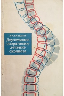 Двухэтапное оперативное лечение сколиоза (БУ). Казьмин А.И.