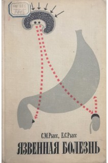 Язвенная болезнь (неосложненная форма) (БУ). Рысс С.М.