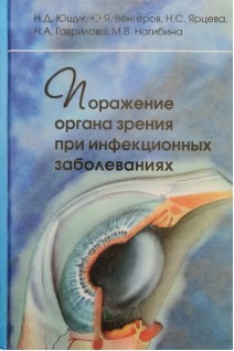 Поражение органа зрения при инфекционных заболеваниях. Ющук Н.Д. Венгеров Ю.Я.