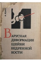 Варусная деформация шейки бедренной кости (БУ). Крюк А.
