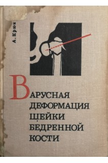 Варусная деформация шейки бедренной кости (БУ). Крюк А.