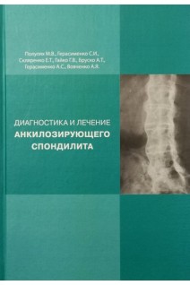 Диагностика и лечение анкилозирующего спондилита. Популях М.В Герасименко С.И. Скляренко Е.Т. и др.