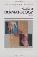 An Atlas of Dermatology. 4th Edition (БУ). Lionel Fry