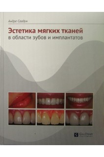 Эстетика мягких тканей в области зубов и имплантатов. Андре Саадун